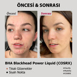 COSRX BHA Blackhead Power Liquid