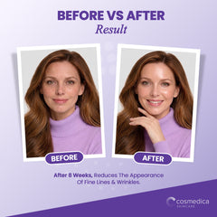 Cosmedica Matrixyl 3000 Peptide Serum with Hyaluronic Acid