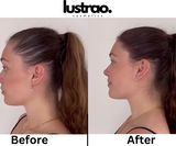 Lustrao Hair Regrowth Oil – Botanical Formula for Visible Growth