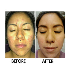 Oil-free serum for clear and balanced skin