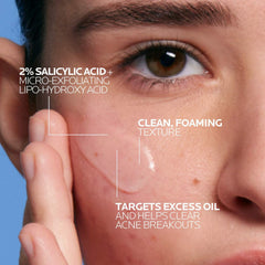 Effaclar Medicated Gel Cleanser 6.76 oz | Acne Face Wash by La Roche-Posay
