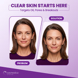 Cosmedica 10% Niacinamide + Zinc Treatment Serum