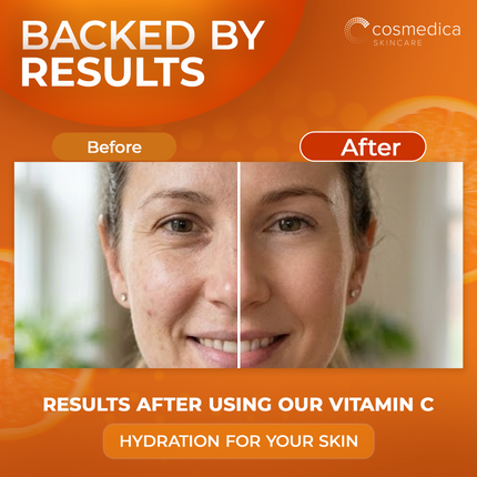 Cosmedica Vitamin C Serum with Hyaluronic Acid