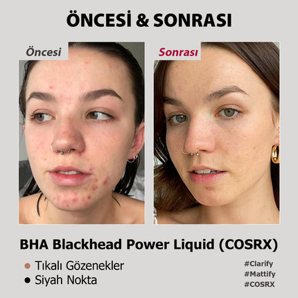 COSRX - BHA Blackhead Power Liquid