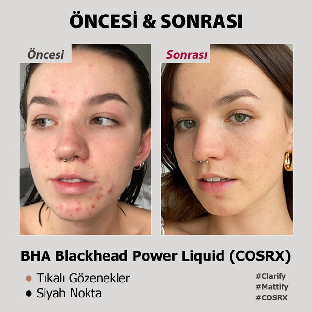 COSRX - BHA Blackhead Power Liquid