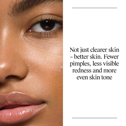 Neutrogena Oil Free Acne Face Wash, 9.1 fl. oz