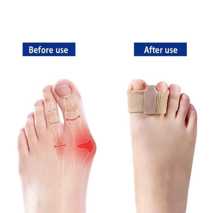 Bunion Ease Toe Separators