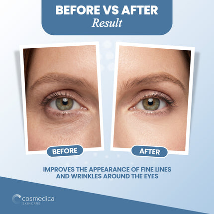 Cosmedica Anti-Aging Hydration Eye Cream