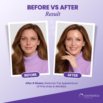 Cosmedica Matrixyl 3000 Peptide Serum with Hyaluronic Acid