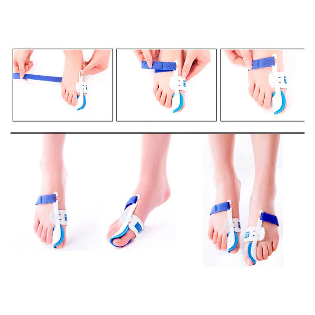 Bunion Corrector Splint | Hallux Valgus Orthopedic Brace for Day & Night Use