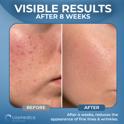 Cosmedica Hyaluronic Acid + Vitamin B5 Serum