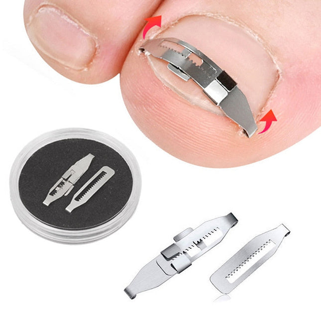 Ingrown Toenail Corrector Kit | Professional Carbon Steel Nail Correction Tool