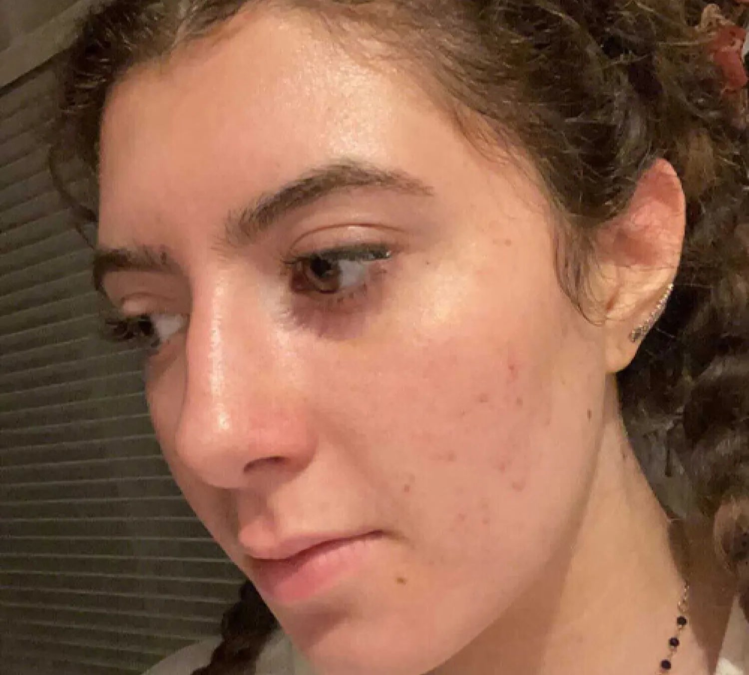 PanOxyl Acne Foaming Wash, Dermatologlar tarafından önerilen PanOxyl Akne Temizleyici Köpük