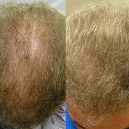 Lustrao Hair Regrowth Oil – Botanical Formula for Visible Growth