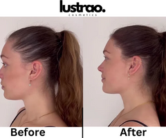 Lustrao Hair Regrowth Oil – Botanical Formula for Visible Growth