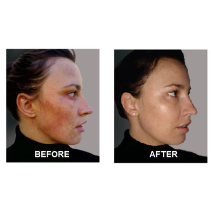 Oil-free serum for clear and balanced skin