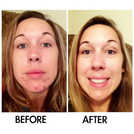 Oil-free serum for clear and balanced skin
