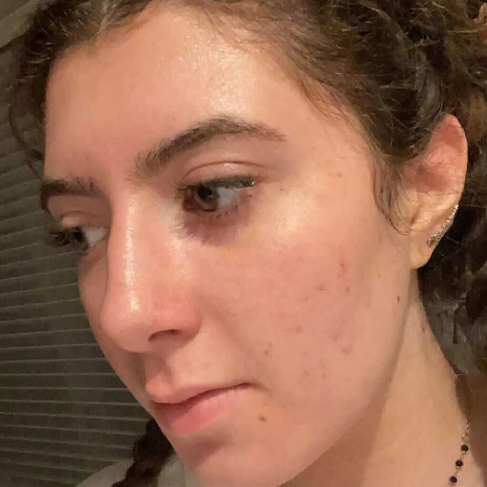 PanOxyl Acne Foaming Wash