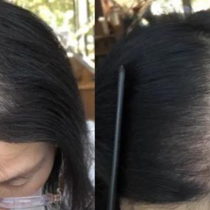 Lustrao Hair Regrowth Oil – Botanical Formula for Visible Growth